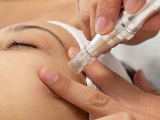 Dermapen facial 